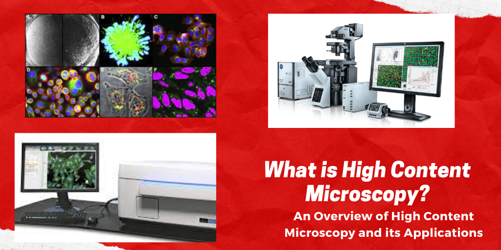 What is High Content Microscopy?